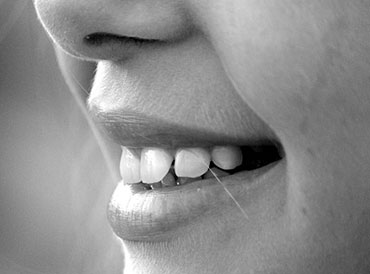 Braces in Sonora, TX